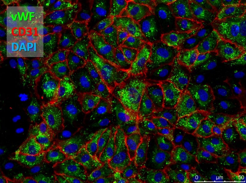 Human Brain Microvascular Endothelial Cells (HBMVEC)
